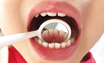 足立区西新井の歯医者ホリ歯科診療内容「小児歯科」の写真